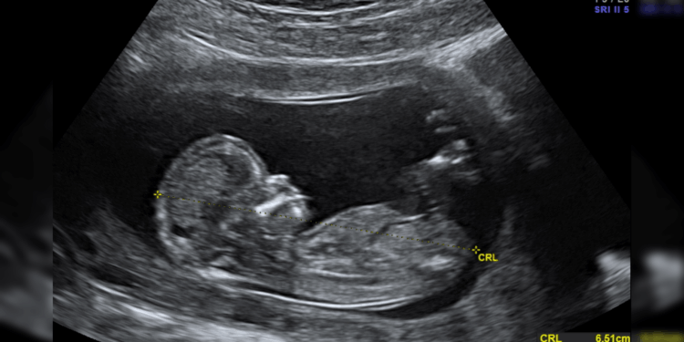 Priests for Life: Call on the FDA to End Death by Chemical Abortion | The Gateway Pundit