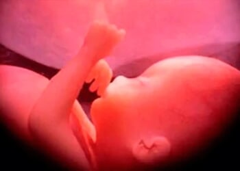Catholics across the U.S. encouraged to participate in Respect Life Novena – Catholic World Report