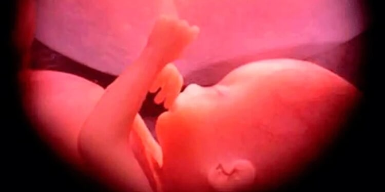 Catholics across the U.S. encouraged to participate in Respect Life Novena – Catholic World Report