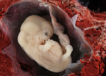 80 Years After Nuremberg Condemned Nazi Research, Doctors Are Still Committing Atrocities