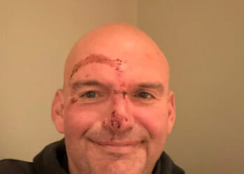 John Fetterman Makes 'Full Recovery' After Sustaining Injuries from Fall