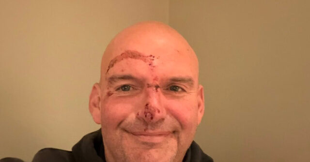 John Fetterman Makes 'Full Recovery' After Sustaining Injuries from Fall