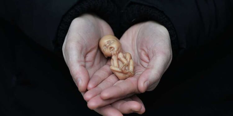 Why the pro-life movement fails without a Christian worldview