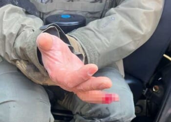 Rioter bit off part of federal agent's finger amid Minneapolis 'rampant assault,' DHS says