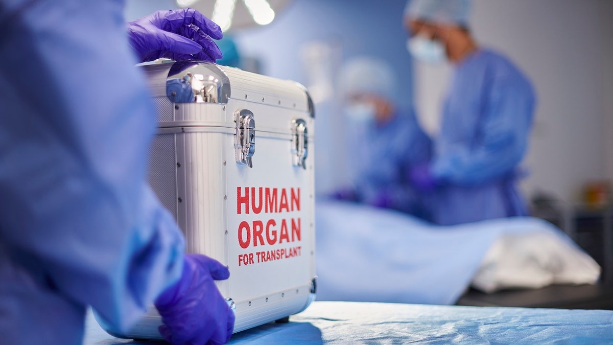 Human organ transplantation.