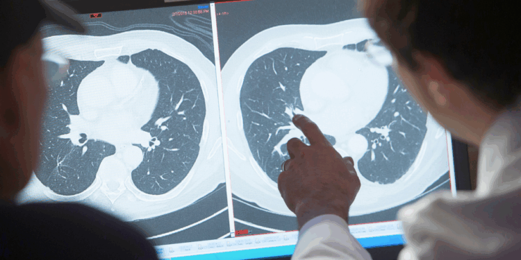 Eradicating cancer could boost the US economy by $185T, report finds