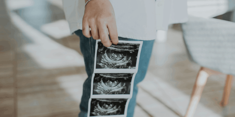 Indiana Court Murders The English Language And Law To Call Abortion ‘Religious Exercise’