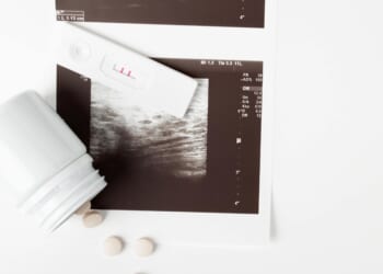 U.S. chemical abortions as a result of telehealth rise by 25%, report finds