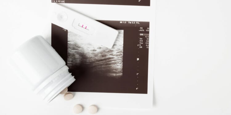 U.S. chemical abortions as a result of telehealth rise by 25%, report finds