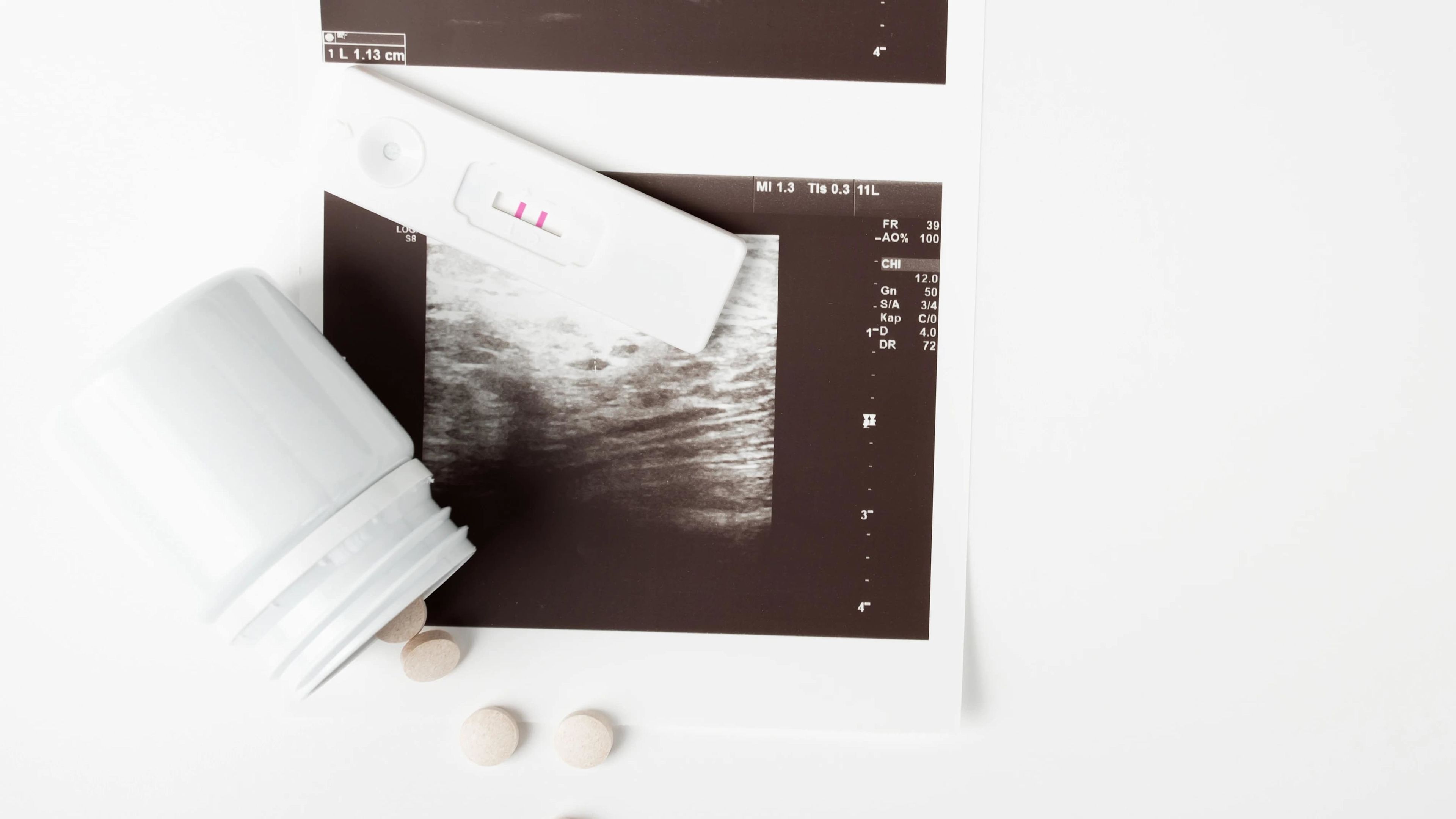 U.S. chemical abortions as a result of telehealth rise by 25%, report finds 