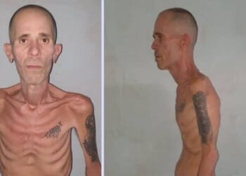 Outrage as Cuba Releases Political Prisoner in ‘Concentration Camp’ Conditions